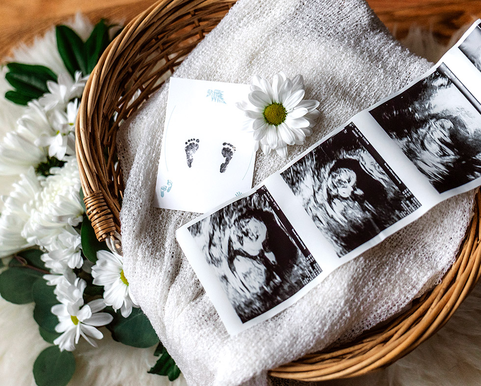 basket of ultrasound photos and baby's footprints